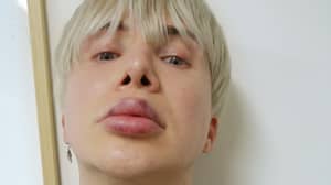 英国K-Pop歌手因唇部整容而不能正常演唱